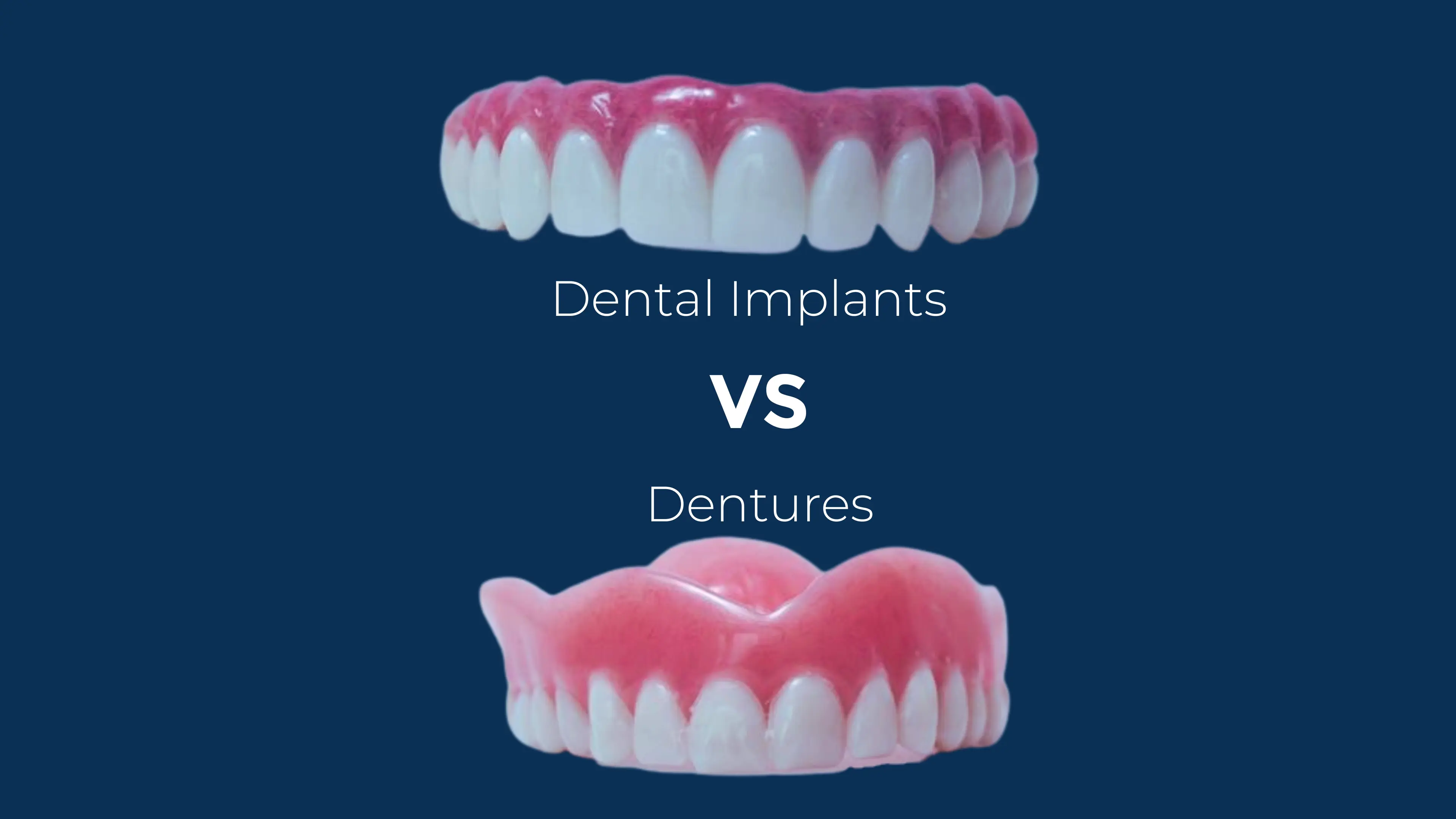 Dental Implants vs Dentures in 2025: Costs, Comfort & What Lasts Longest