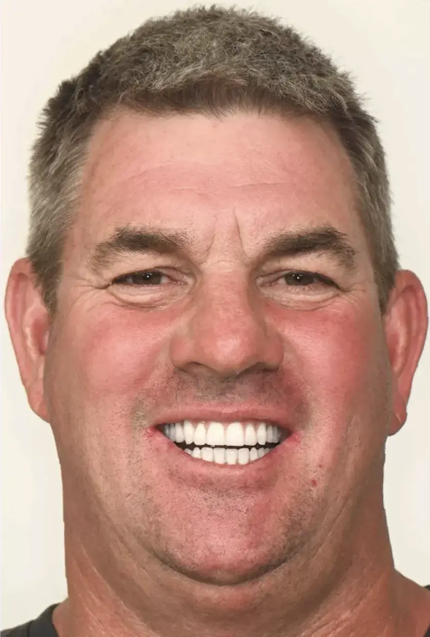 Anthony R. Mitchell after