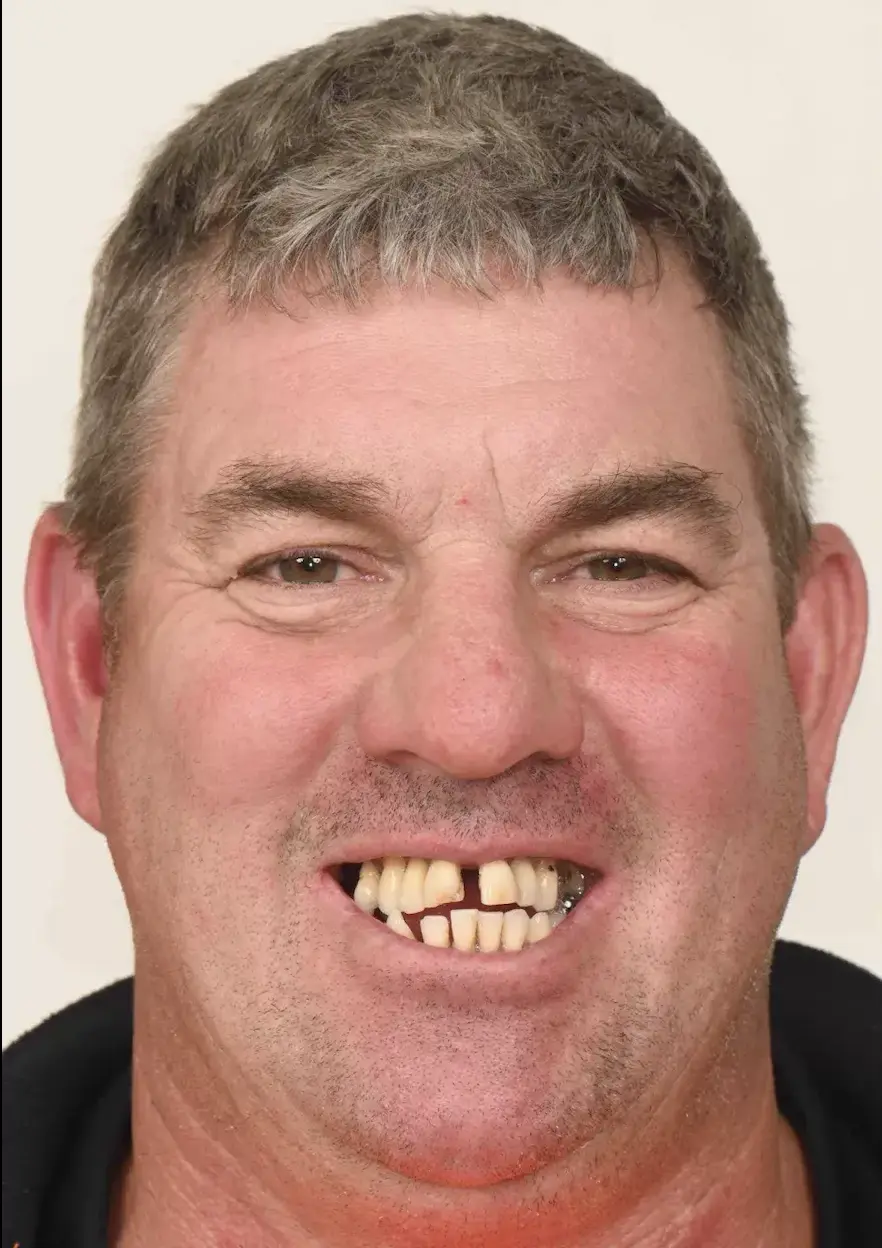 Anthony R. Mitchell before