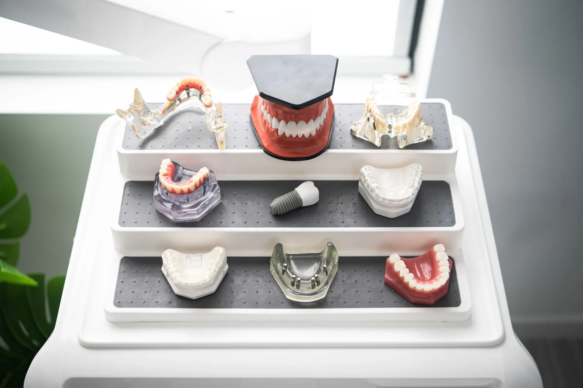 Before and After All-on-8 Robust Implants