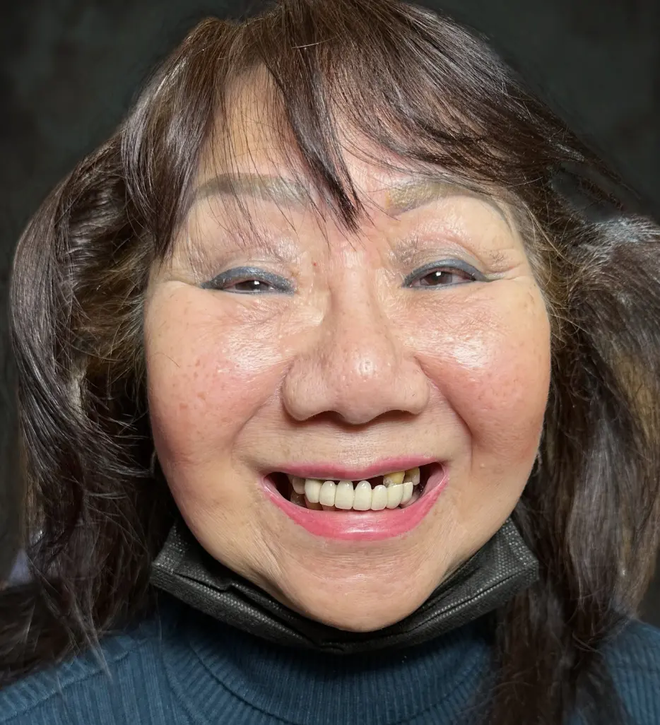 Linda K. Wong - before